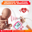 MONITOR DE RITMO CARDIACO FETAL DOPPLER